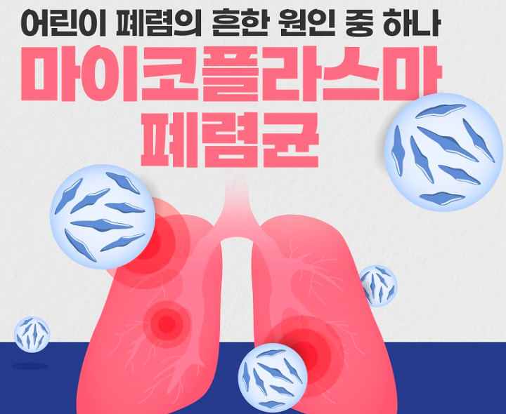 마이코플라스마 폐렴