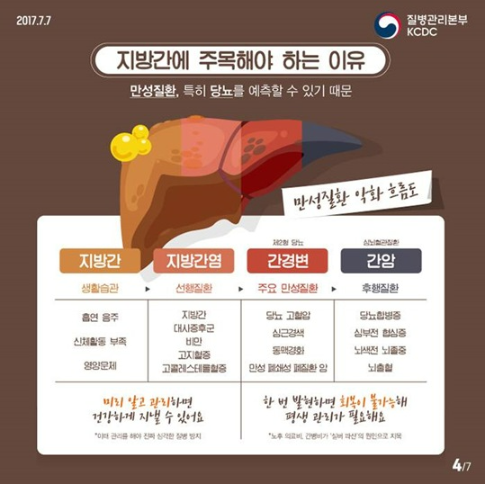 간(5)