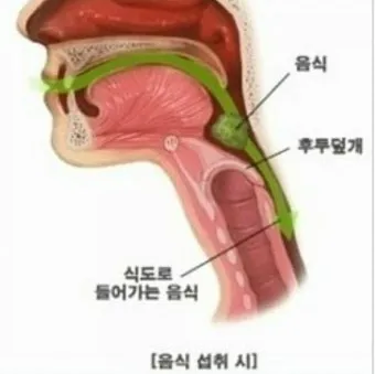 사래가 잘 걸리는 이유 사래 걸렸을때 대처법_4