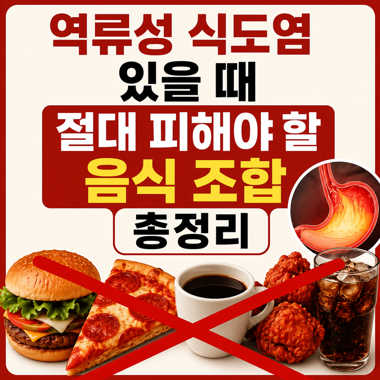 역류성 식도염은 음식 조합