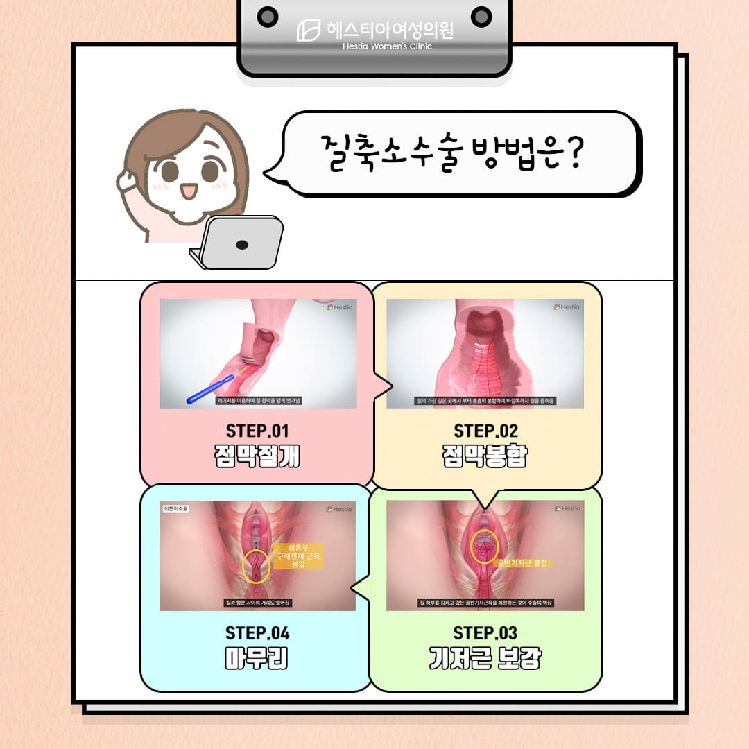 질탄력 개선 수술방법은?