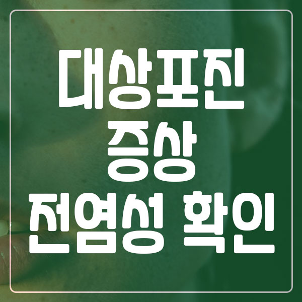 대상포진 증상 전염성 예방법