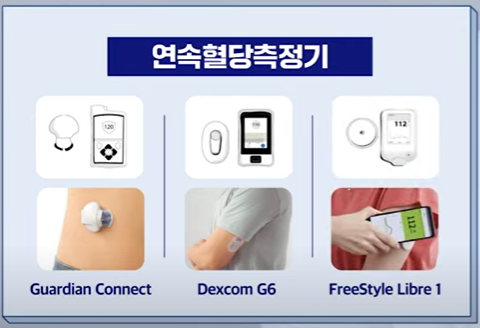 연속혈당측정기