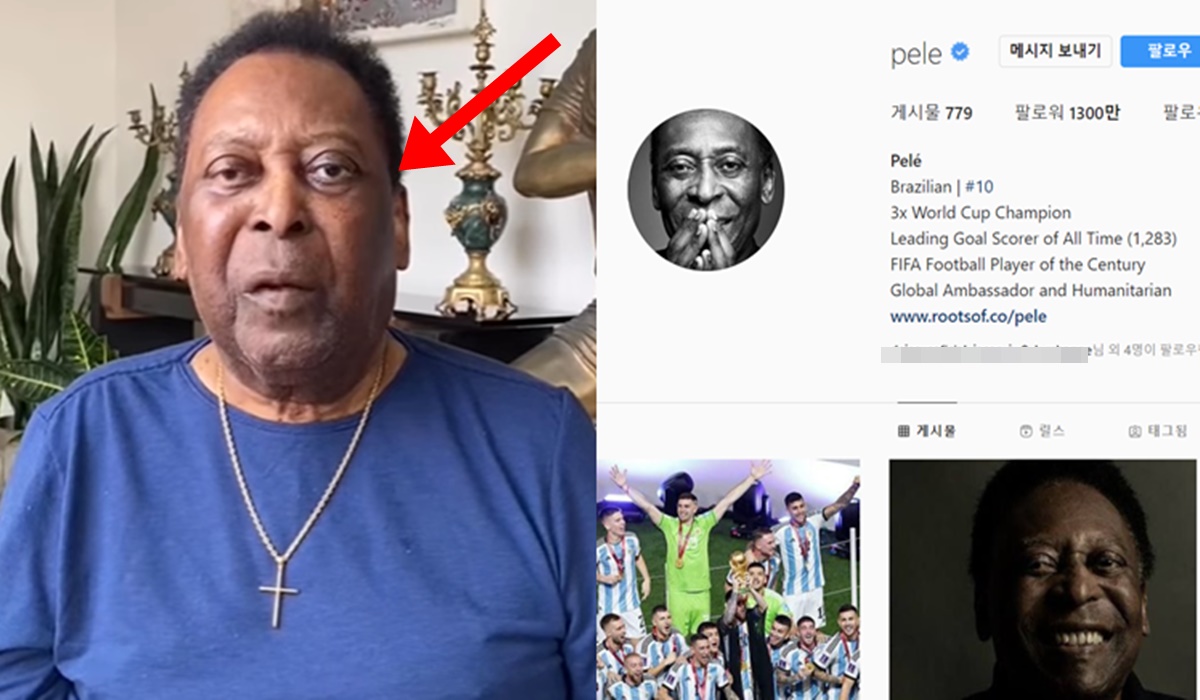 브라질 축구황제 펠레 대장암 건강 악화 사망 및 장례식 준비