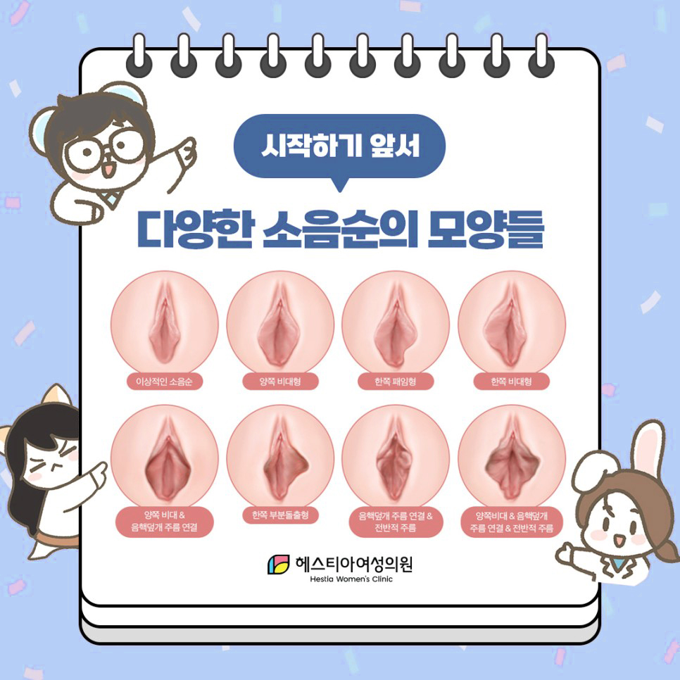 다양한 소음순의 모양들