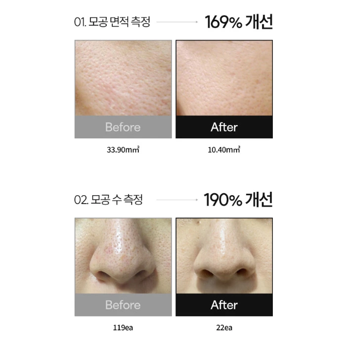 더시드 모공픽서 내돈내산 후기 사용법 효과 부작용 가격
