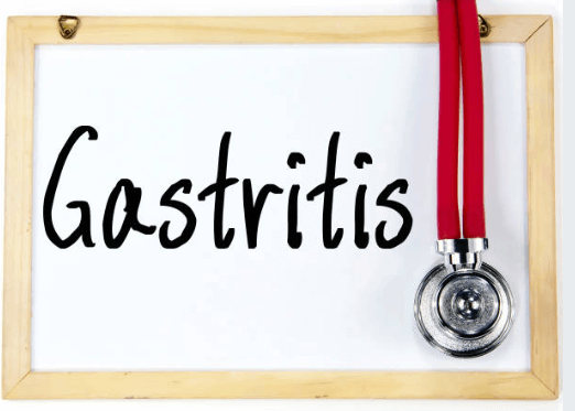 위축성 위염 증상, 원인, 치료 총정리