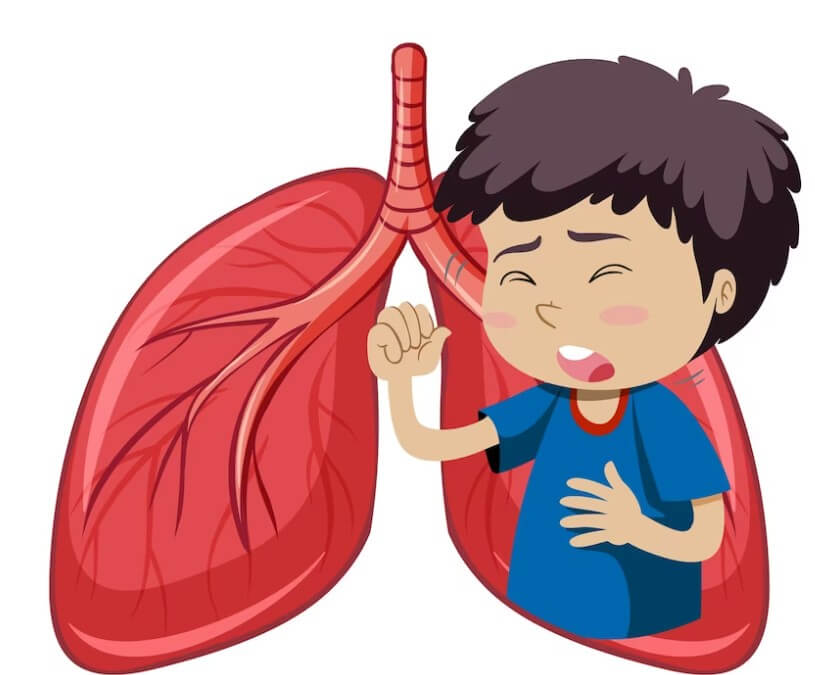 폐렴 사진입니다.