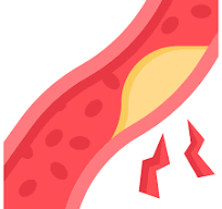 총콜레스테롤 정상수치