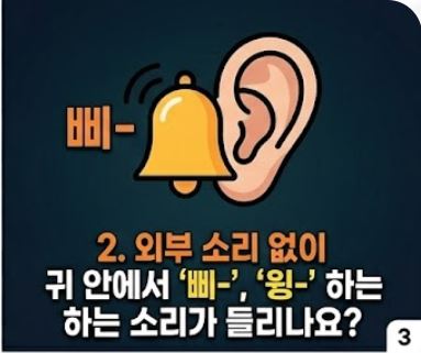돌발성 난청