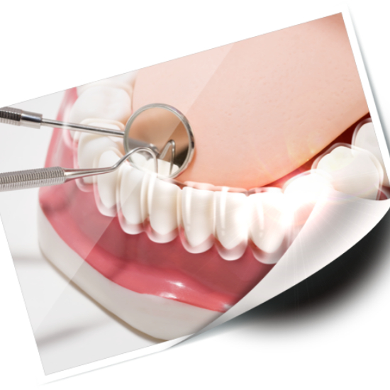 임플란트 시술과정 단계별 설명14