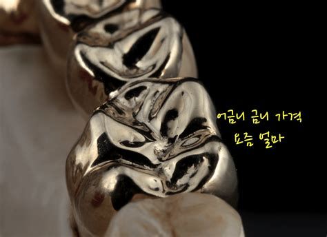 금니가격