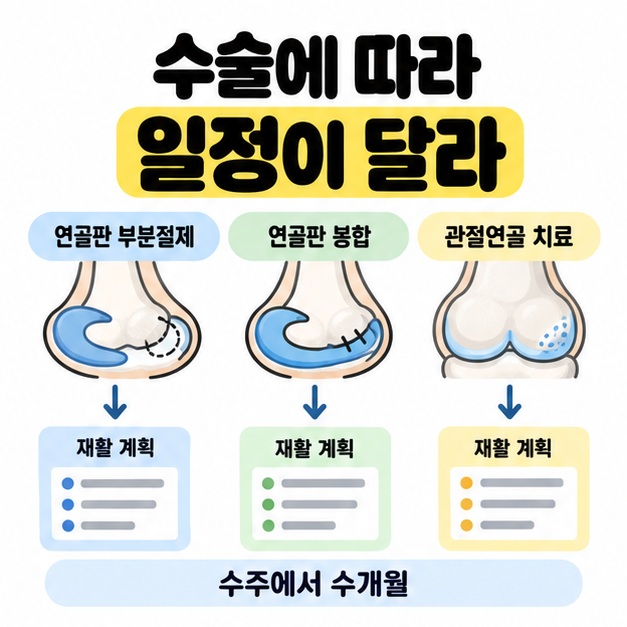 연골판 부분절제와 연골판 봉합, 관절연골 치료를 각각 재활 계획에 연결하고 수주에서 수개월이라는 참고 범위를 표시한 분류 도식