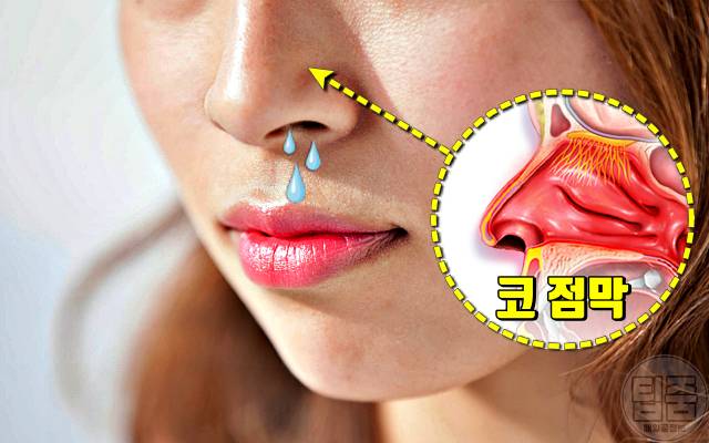 콧물 목 뒤로 넘어가요 후비루 원인 비염