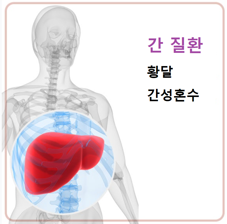간질환의-종류