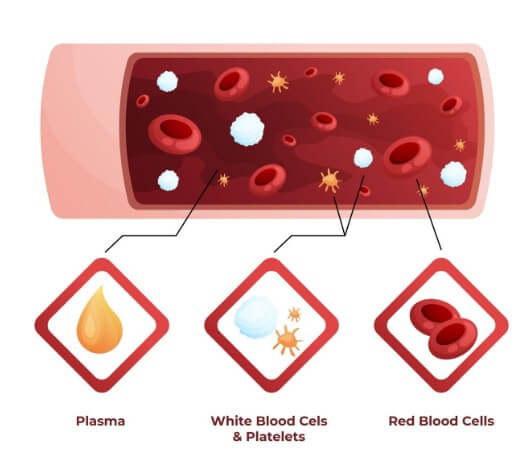 혈관 속 노폐물