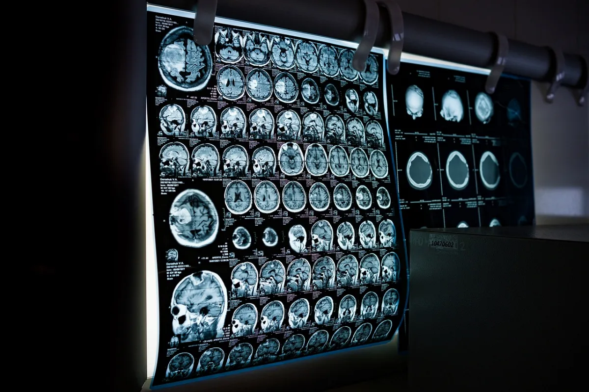 CT-MRI-영상검사이미지