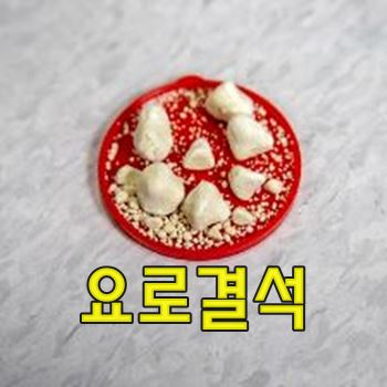 요로결석 원인