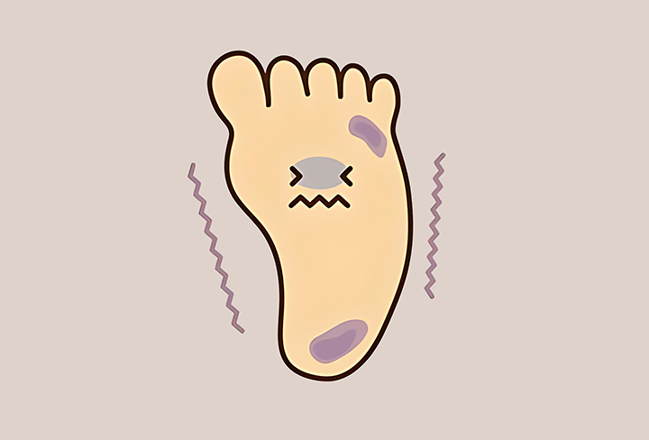 노화로-인한-족저근막염