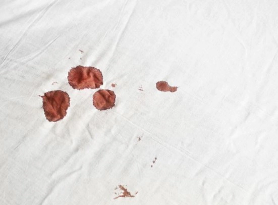 착상혈 생리 차이점 6가지