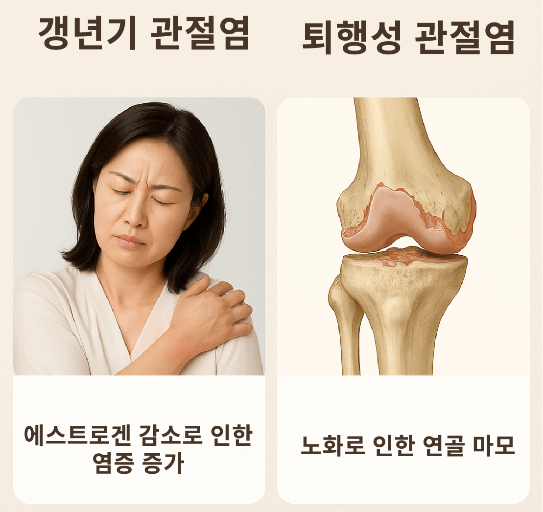 갱년기 관절염 증상 원인 치료법