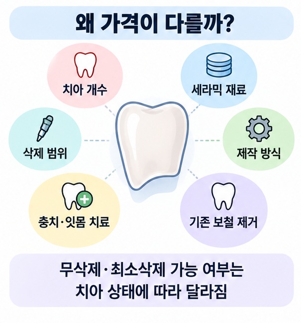 라미네이트 가격 차이에 영향을 주는 치아 수 제작 방식 추가 진료 요소 인포그래픽