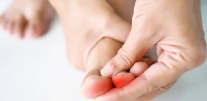 요산 수치 낮추는 법