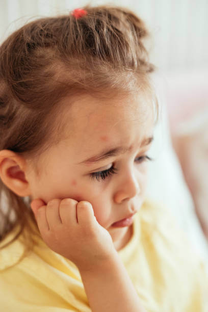 베트남 홍역증상, 예방접종 (+여행 전 꼭 확인해야 하세요)