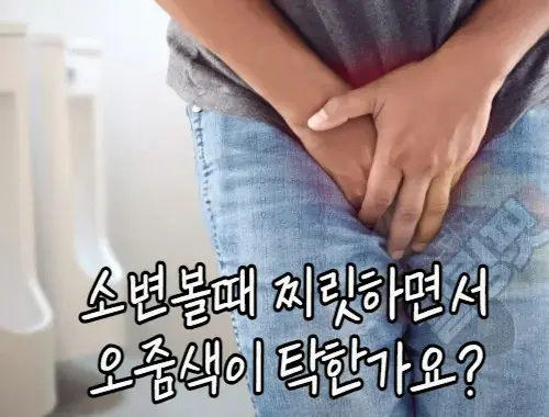 소변색이-탁하면서-찌릿하다면