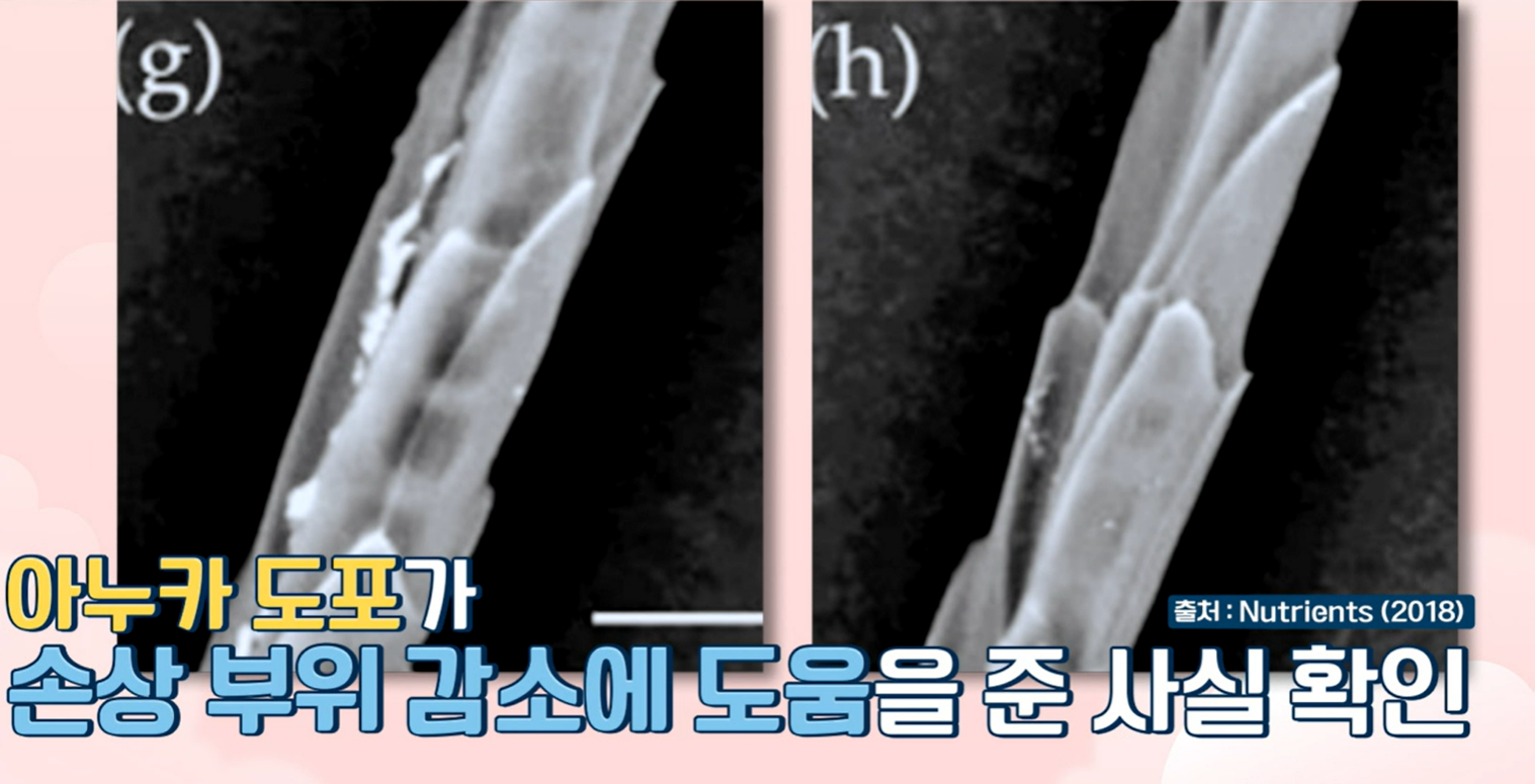 아누카사과 효능