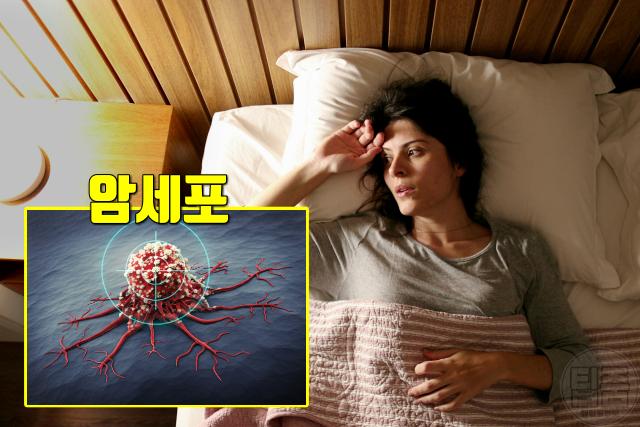 방광암 증상 피로감 심한 이유