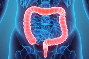 대장에 좋은 음식04