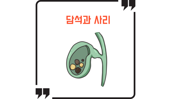 담낭에 생긴 담석의 모습