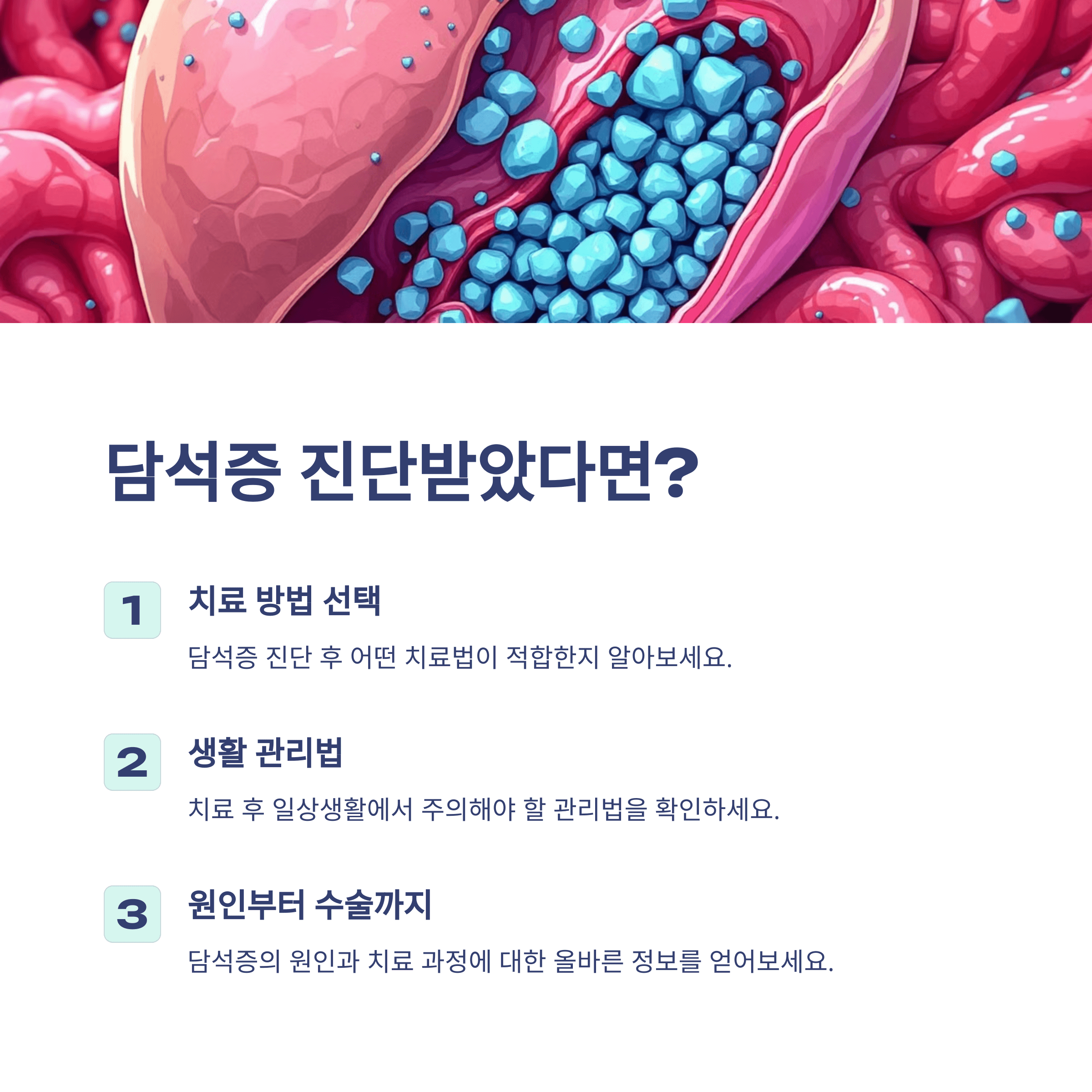 담석증 진단받았다면?