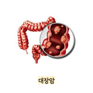 BMI-지수-계산법