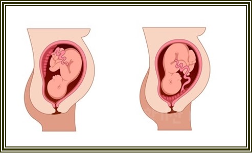 임신중 부부관계를 피해야하는 경우 6가지