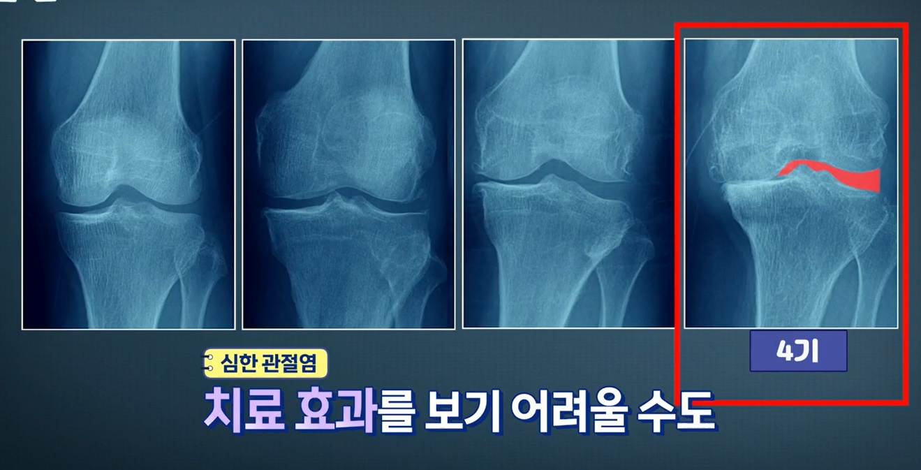 가자추출물