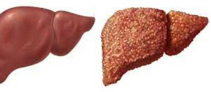 연근 효능 - 지방간 개선