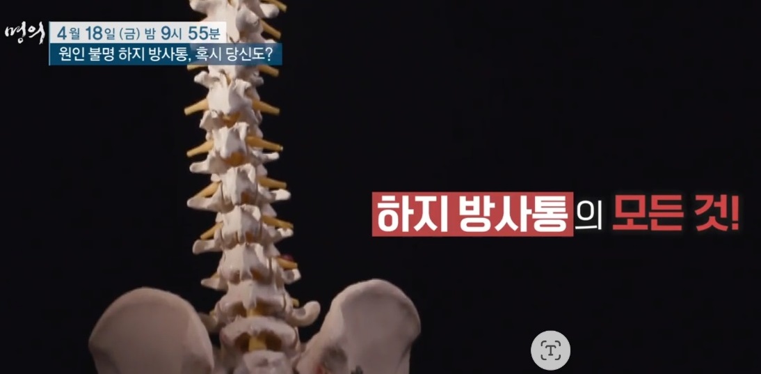 하지방사통의모든것