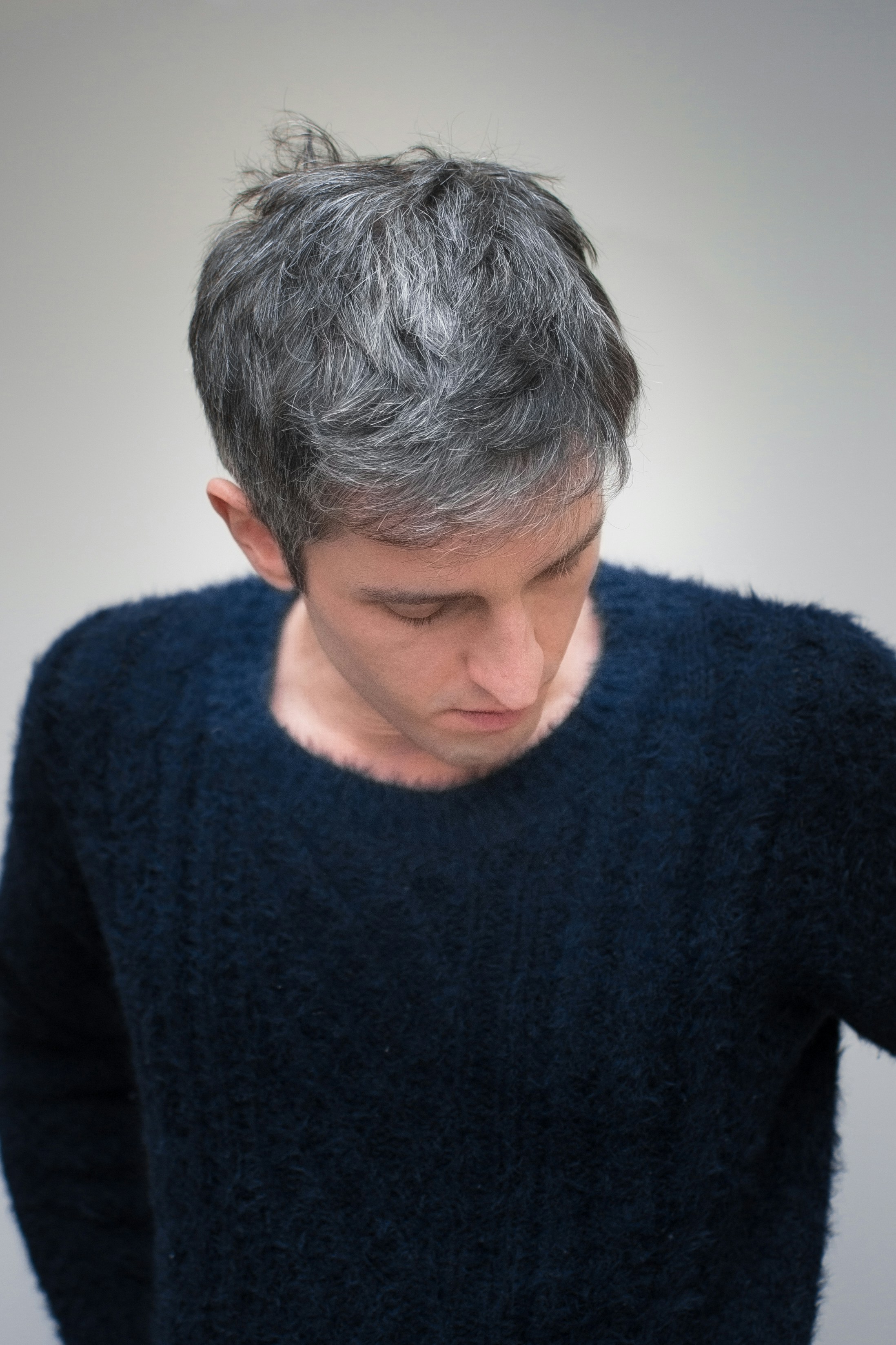 Young man with premature graying