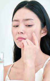 얼굴이 붉어지는 증상