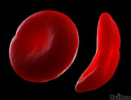 혈핵학-유전자 편집(CRISPR) 기반 혈액형 변환 연구