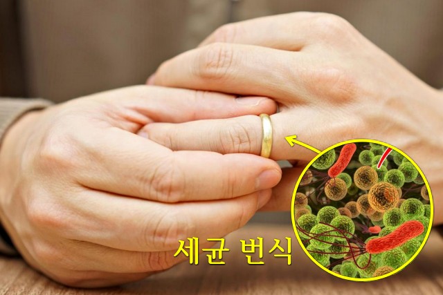 반지 안빼고 자면, 반지 주얼리 브랜드 추천 제이에스티나, 팁줌