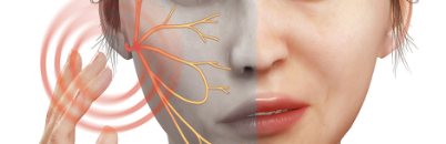 구안와사 초기증상2