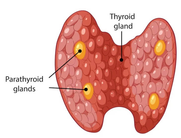 갑상선암 초기증상