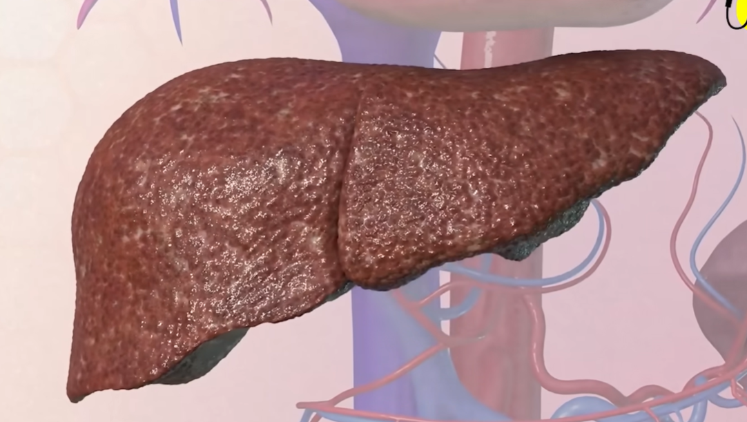 간수치 내리는 방법