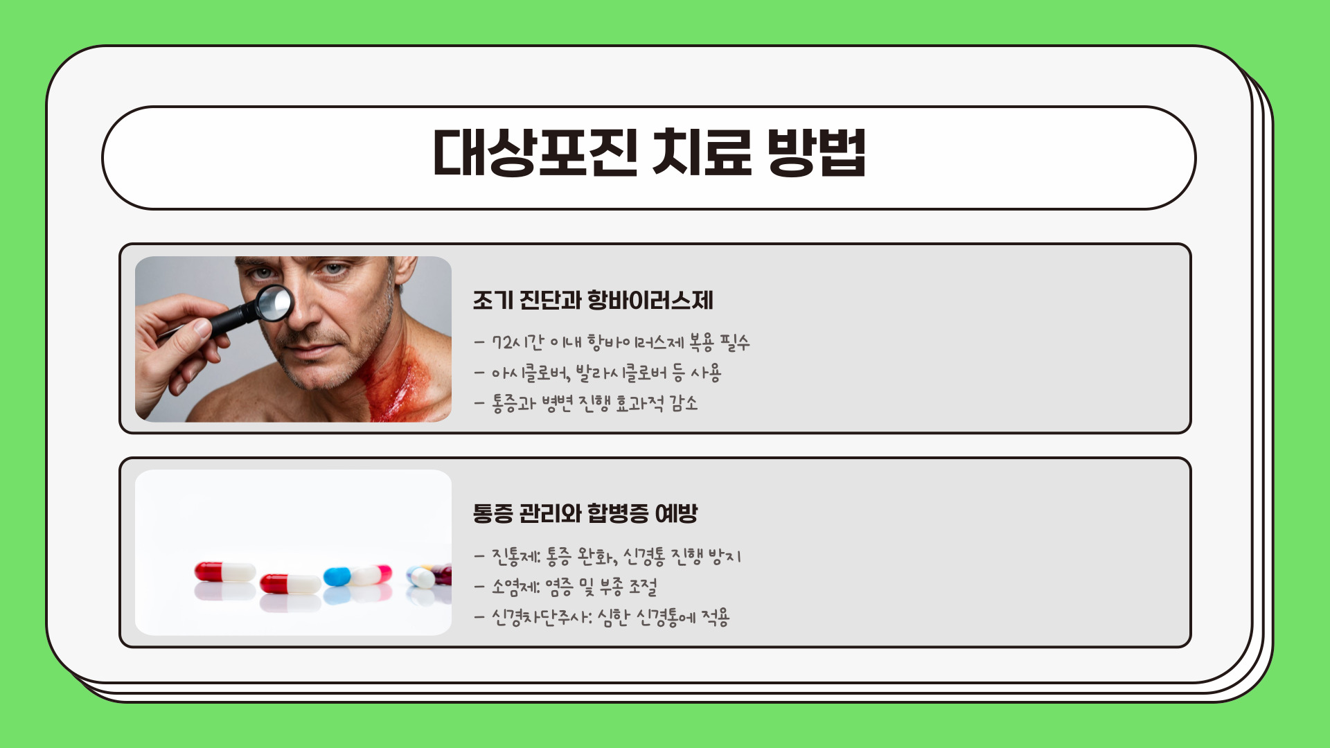 대상포진 초기증상