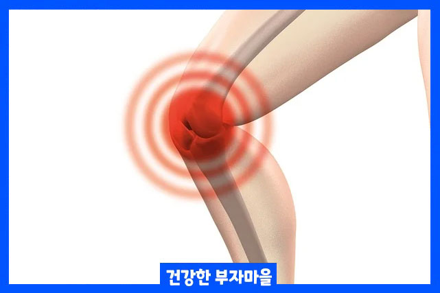 무릎통증 원인 7가지