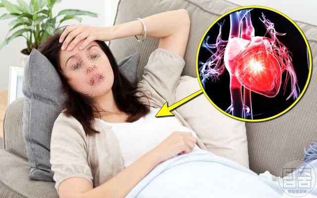 여자 심장마비 전조증상,피로감,팁줌
