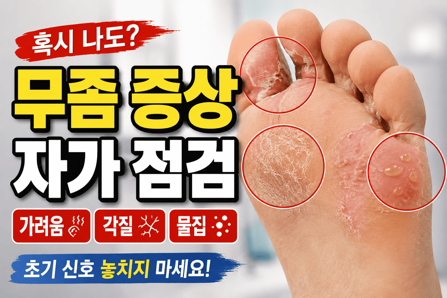 무좀 증상 점검(가려움, 각질, 물집)
